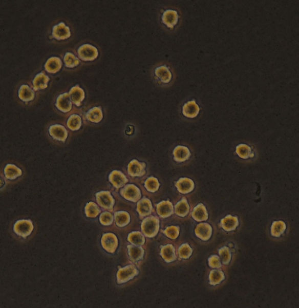 ملف:Hybridoma cells grown in tissue culture.jpg